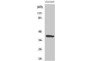 Western Blotting (WB) image for anti-Purinergic Receptor P2Y, G-Protein Coupled, 14 (P2RY14) (Internal Region) antibody (ABIN3180067) (P2RY14 Antikörper  (Internal Region))