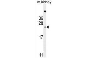 ADO Antibody (C-term) western blot analysis in mouse kidney tissue lysates (35µg/lane). (ADO Antikörper  (C-Term))