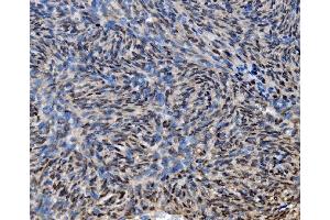 IHC analysis of CDC27 using anti-CDC27 antibody (ABIN7602163). (CDC27 Antikörper  (AA 609-824))