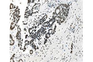 IHC analysis of NRF1 using anti-NRF1 antibody (ABIN7600874). (NRF1 Antikörper  (AA 246-503))