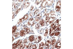 Immunohistochemistry of paraffin-embedded human stomach using DTNBP1 antibody (ABIN7266870) at dilution of 1:100 (40x lens).