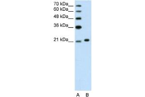 WB Suggested Anti-ANK1 Antibody Titration:  1. (Erythrocyte Ankyrin Antikörper  (C-Term))