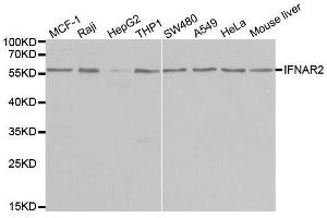 Western blot analysis of extracts of various cell lines, using IFNAR2 antibody. (IFNAR2 Antikörper  (AA 27-243))