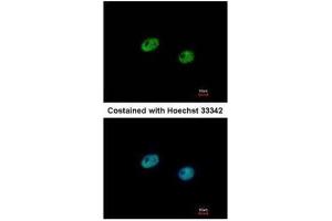 ICC/IF Image Immunofluorescence analysis of paraformaldehyde-fixed HeLa, using IRF5, antibody at 1:500 dilution. (IRF5 Antikörper  (C-Term))