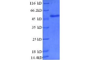 SDS-PAGE (SDS) image for Zinc Finger, BED-Type Containing 1 (ZBED1) (AA 1-210), (partial) protein (GST tag) (ABIN5712247)