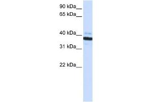 OAS1 antibody used at 1 ug/ml to detect target protein. (OAS1 Antikörper  (C-Term))