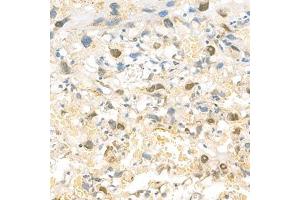 Immunohistochemistry (Paraffin-embedded Sections) (IHC (p)) image for anti-Eukaryotic Translation Initiation Factor 2, Subunit 2 Beta, 38kDa (EIF2S2) antibody (ABIN7073880)