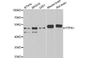Western blot analysis of extracts of various cell lines, using PTPN1 antibody (ABIN5970769) at 1/1000 dilution. (PTPN1 Antikörper)