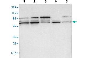 Western blot analysis of lane 1: RT-4, lane 2: EFO-21, lane 3: A-431, lane 4: Liver and lane 5: Tonsil using PCTK1 polyclonal antibody . (CDK16 Antikörper)