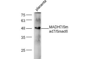 Mouse placenta lysate probed with Anti-Smad7 + Smad6 Polyclonal Antibody  at 1:5000 90min in 37˚C.