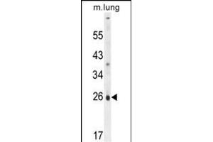 PQLC1 Antibody (Center) (ABIN654821 and ABIN2844494) western blot analysis in mouse lung tissue lysates (35 μg/lane). (PQLC1 Antikörper  (AA 100-128))