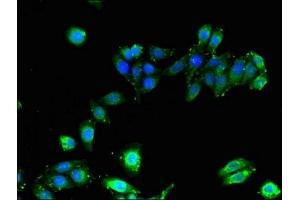 Immunofluorescent analysis of HepG2 cells using ABIN7155621 at dilution of 1:100 (HLA-B Antikörper  (AA 25-308))