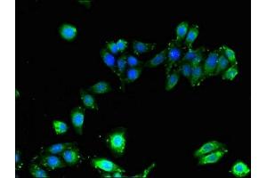 Immunofluorescent analysis of HepG2 cells using ABIN7155621 at dilution of 1:100