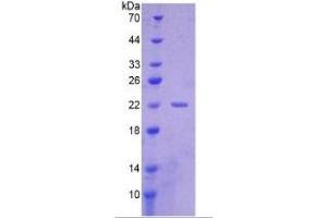 SDS-PAGE of Protein Standard from the Kit (Highly purified E. (CYFRA21.1 ELISA Kit)