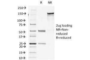 SDS-PAGE Analysis Purified Insulin Mouse Monoclonal Antibody (E2-E3+2D11-H5). (Insulin Antikörper)