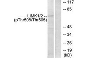 Western blot analysis of extracts from COLO205 cells, using LIMK1 (Phospho-Thr508) Antibody. (LIM Domain Kinase 1 Antikörper  (pThr508))