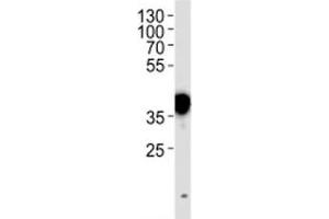 NPM1 antibody western blot analysis in HeLa lysate. (NPM1 Antikörper  (AA 7-33))