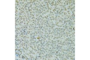 Immunohistochemistry of paraffin-embedded rat spleen using RCC1 antibody (ABIN5973761) at dilution of 1/100 (40x lens). (RCC1 Antikörper)