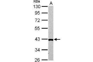 WB Image Arginase II antibody detects ARG2 protein by Western blot analysis. (ARG2 Antikörper  (Center))