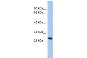 Image no. 1 for anti-Proteasome (Prosome, Macropain) Subunit, beta Type 2 (PSMB2) (C-Term) antibody (ABIN6744081) (PSMB2 Antikörper  (C-Term))