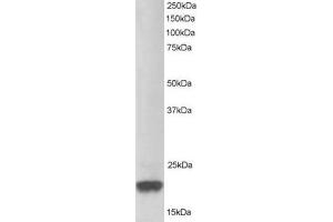 Image no. 1 for anti-Parkinson Protein 7 (PARK7) (C-Term) antibody (ABIN374310) (PARK7/DJ1 Antikörper  (C-Term))
