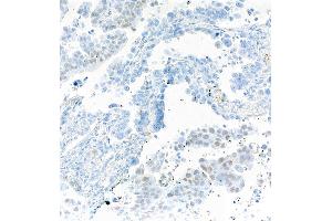 Immunohistochemistry (IHC) image for anti-SRY (Sex Determining Region Y)-Box 2 (SOX2) antibody (ABIN7449421) (SOX2 Antikörper)