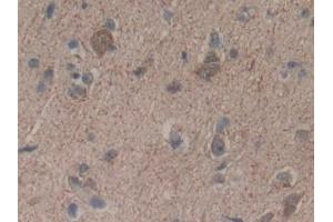 Immunohistochemistry (IHC) image for anti-3-Hydroxy-3-Methylglutaryl-CoA Synthase 1 (Soluble) (HMGCS1) (AA 293-467) antibody (ABIN7434026)