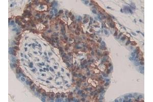 Immunohistochemistry (IHC) image for anti-Chromogranin B (Secretogranin 1) (CHGB) (AA 496-669) antibody (ABIN7435220)