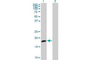 Western Blot analysis of TSEN15 expression in transfected 293T cell line by TSEN15 MaxPab polyclonal antibody. (TSEN15 Antikörper  (AA 1-171))