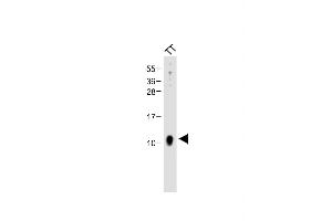 Anti-CALCA Antibody (Center) at 1:2000 dilution + TT whole cell lysate Lysates/proteins at 20 μg per lane. (CGRP Antikörper  (AA 56-83))