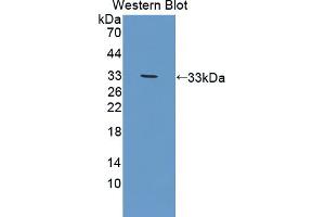 Western blot analysis of the recombinant protein. (DOK3 Antikörper  (AA 45-310))