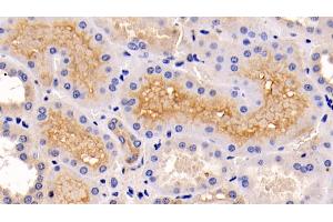 Detection of ERK1 in Human Kidney Tissue using Monoclonal Antibody to Extracellular Signal Regulated Kinase 1 (ERK1) (ERK1 Antikörper  (AA 75-312))