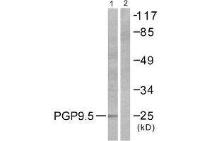 Western Blotting (WB) image for anti-Ubiquitin Carboxyl-terminal Esterase L1 (Ubiquitin Thiolesterase) (UCHL1) (C-Term) antibody (ABIN1848743) (UCHL1 Antikörper  (C-Term))