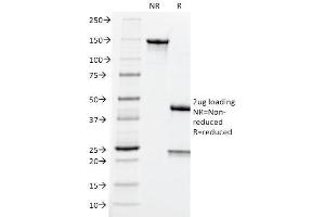 SDS-PAGE Analysis Purified CEA Mouse Monoclonal Antibody (CEA31). (CEACAM5 Antikörper)