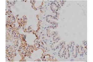 ABIN6267331 at 1/200 staining Rat lung tissue sections by IHC-P. (LYN Antikörper  (pTyr507))