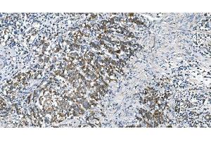 IHC analysis of DRP1/DNM1L using anti-DRP1/DNM1L antibody (ABIN7602180). (Dynamin 1-Like Antikörper  (AA 618-736))