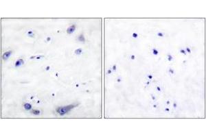 Immunohistochemistry (IHC) image for anti-Tyrosine Hydroxylase (TH) (AA 1-50) antibody (ABIN2888584) (Tyrosine Hydroxylase Antikörper  (AA 1-50))