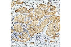 IHC analysis of BUB1B using anti-BUB1B antibody (ABIN7600962). (BUB1B Antikörper  (AA 26-448))
