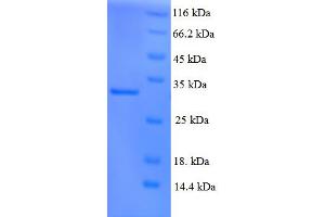 Xeroderma Pigmentosum, Complementation Group C (XPC) (AA 496-734) protein (His tag)
