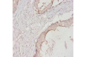 Immunohistochemistry of paraffin-embedded human prostate tissue using ABIN7142091 at dilution of 1:20