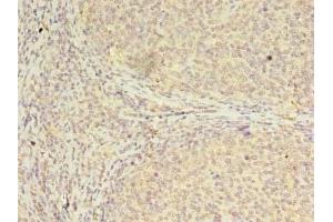 Immunohistochemistry of paraffin-embedded human tonsil tissue using ABIN7147697 at dilution of 1:100 (CBX2 Antikörper  (AA 1-211))