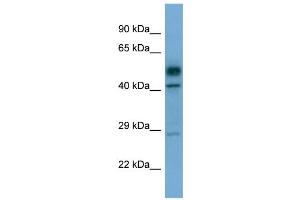 Western Blotting (WB) image for anti-serine/threonine Kinase 17a (STK17A) (C-Term) antibody (ABIN2787865) (STK17A Antikörper  (C-Term))