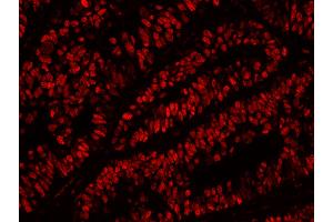 Immunofluorescence (IF) image for anti-Minichromosome Maintenance Complex Component 2 (MCM2) (AA 1-50) antibody (ABIN7448987) (MCM2 Antikörper  (AA 1-50))