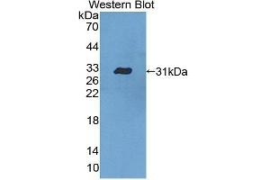 Detection of Recombinant CASP10, Human using Polyclonal Antibody to Caspase 10 (CASP10) (Caspase 10 Antikörper  (AA 223-459))