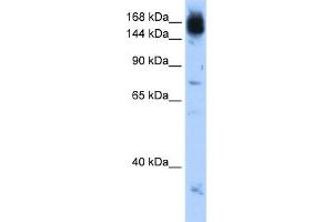 WB Suggested Anti-NCAPD2 Antibody Titration:  0. (NCAPD2 Antikörper  (C-Term))
