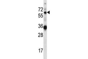 GATAD2B antibody western blot analysis in mouse heart tissue lysate (GATAD2B Antikörper  (AA 1-30))