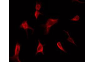 Immunofluorescence (fixed cells) (IF/ICC) image for anti-Spleen tyrosine Kinase (SYK) (pTyr525) antibody (ABIN6255944)