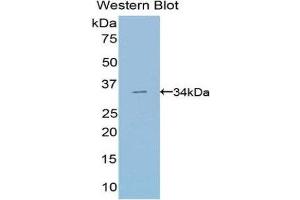 Western Blotting (WB) image for anti-Suppressor of Variegation 4-20 Homolog 2 (SUV420H2) (AA 2-279) antibody (ABIN1078551) (SUV420H2/KMT5C Antikörper  (AA 2-279))
