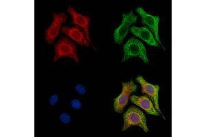 ABIN6257428 and ABIN6275868 staining H2O2 treated Hela cells by IF/ICC. (CD90 Antikörper  (Internal Region))