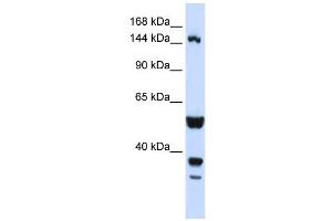ABI3BP antibody used at 1 ug/ml to detect target protein. (ABI3BP Antikörper)